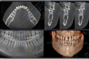 Principes de la chirurgie sur mesure